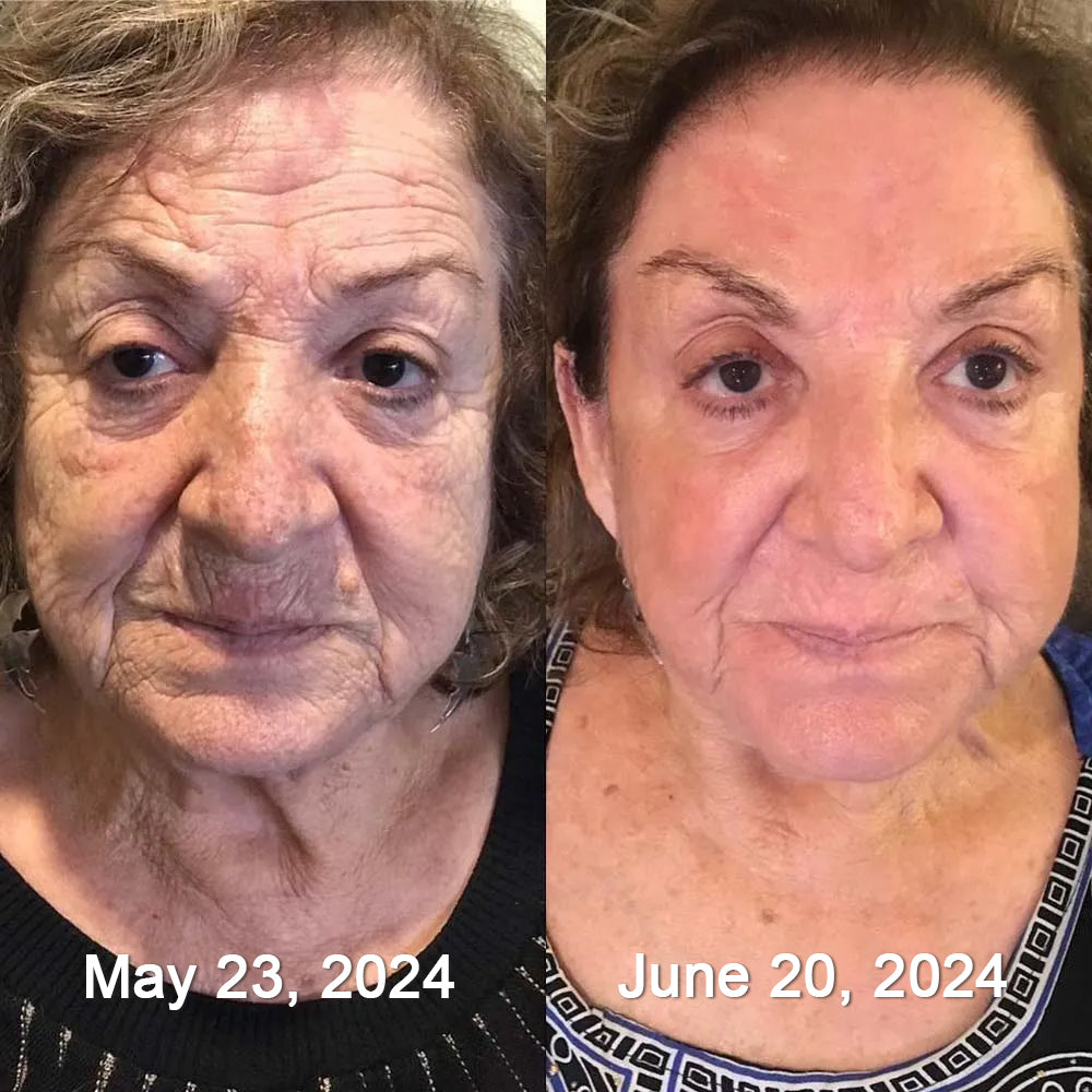 Crema Antiarrugas con BOTOX y Veneno de Abeja - Promoción 2x1