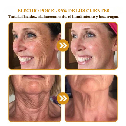 Crema Antiarrugas con BOTOX y Veneno de Abeja - Promoción 2x1