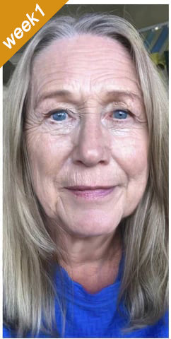 Crema Antiarrugas con BOTOX y Veneno de Abeja - Promoción 2x1