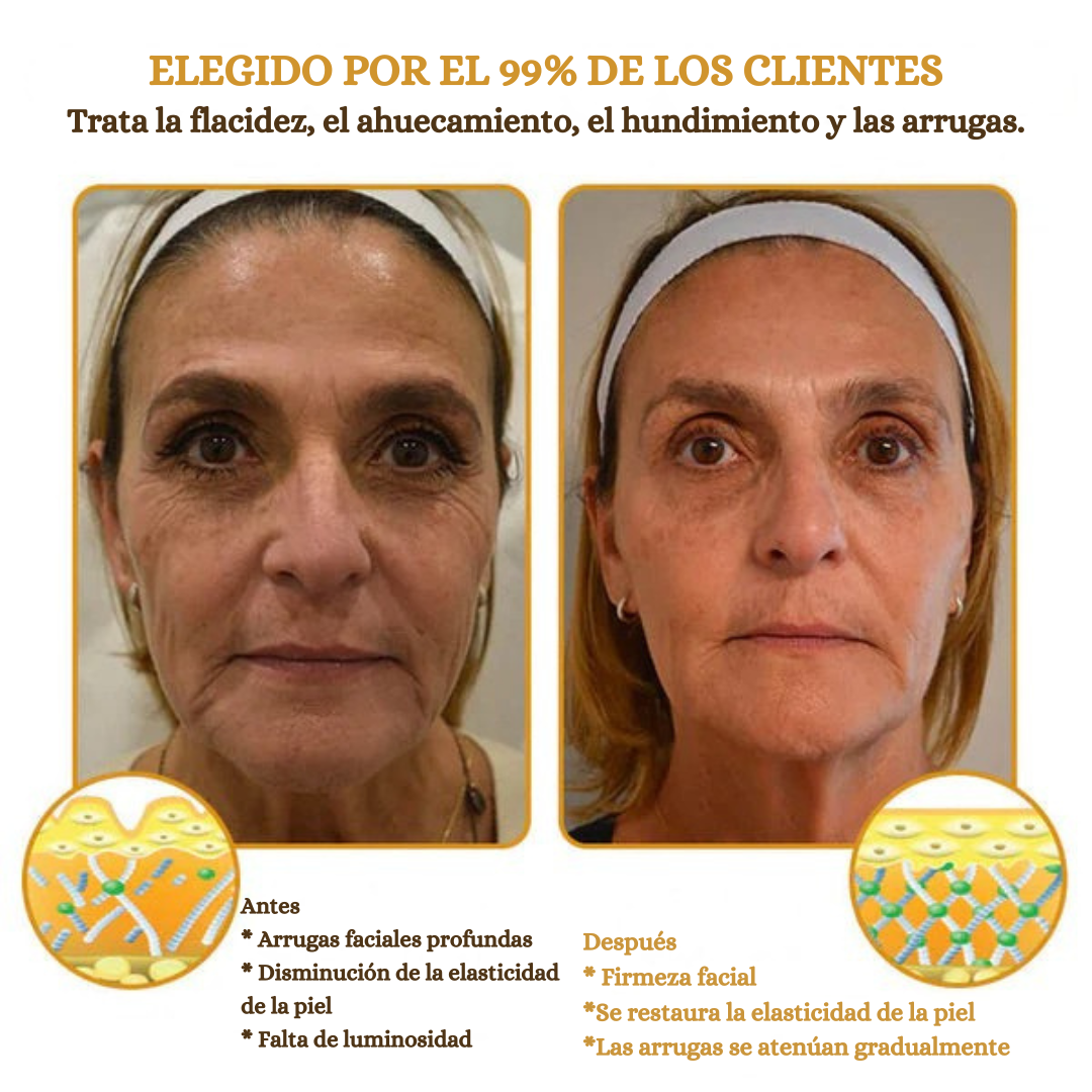 Crema Antiarrugas con BOTOX y Veneno de Abeja - Promoción 2x1